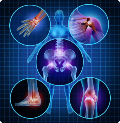 Musculoskeletal