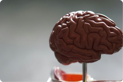 MRI Brain