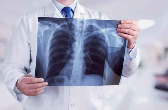 X-ray Use